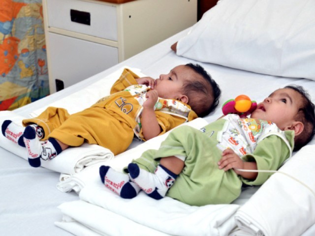 Successful Operation at Aga Khan University Hospital, Pakistan: Conjoined twins separated through surgery
