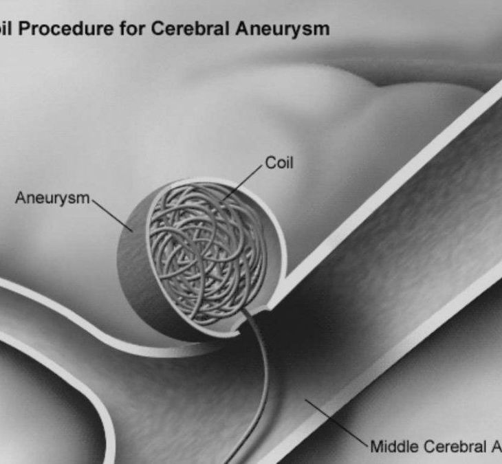 Aga Khan University Hospital, Nairobi introduces new way to treat brain injury