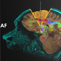 Ontario Association of Architects – 2016 People’s Choice Award: Vote for your favorite project!