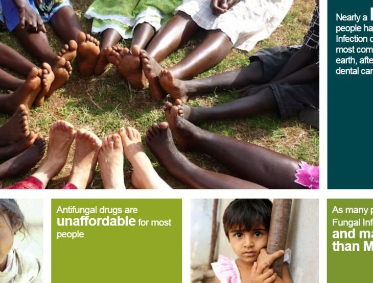 AKU's Dr Kauser Jabeen's Statement on the lack of life-saving, safer anti-fungal medicines in Pakistan