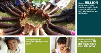 AKU's Dr Kauser Jabeen's Statement on the lack of life-saving, safer anti-fungal medicines in Pakistan