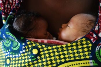 Kangaroo Mother Care Helps Premature Babies Thrive 20 Years Later