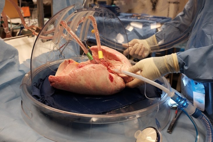 ex-vivo-lung-perfusion-system-evlp